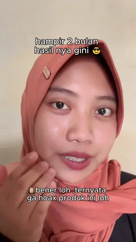 Flek juga bisa di pudarin dengan chalonese guyyss😉✨#fyppppppppppppppppppppppp #masukberandafyp #wajibcoba #solusijerawat #ForYourBeauty #skincareroutine #skincareviral #viralvideo1million #produkhemat #chalonesecreamwhiteningandfreckleremoval #skincaretips #chalonese #chaloneseskincare #garishalus #wajahglowing #cerahglowing