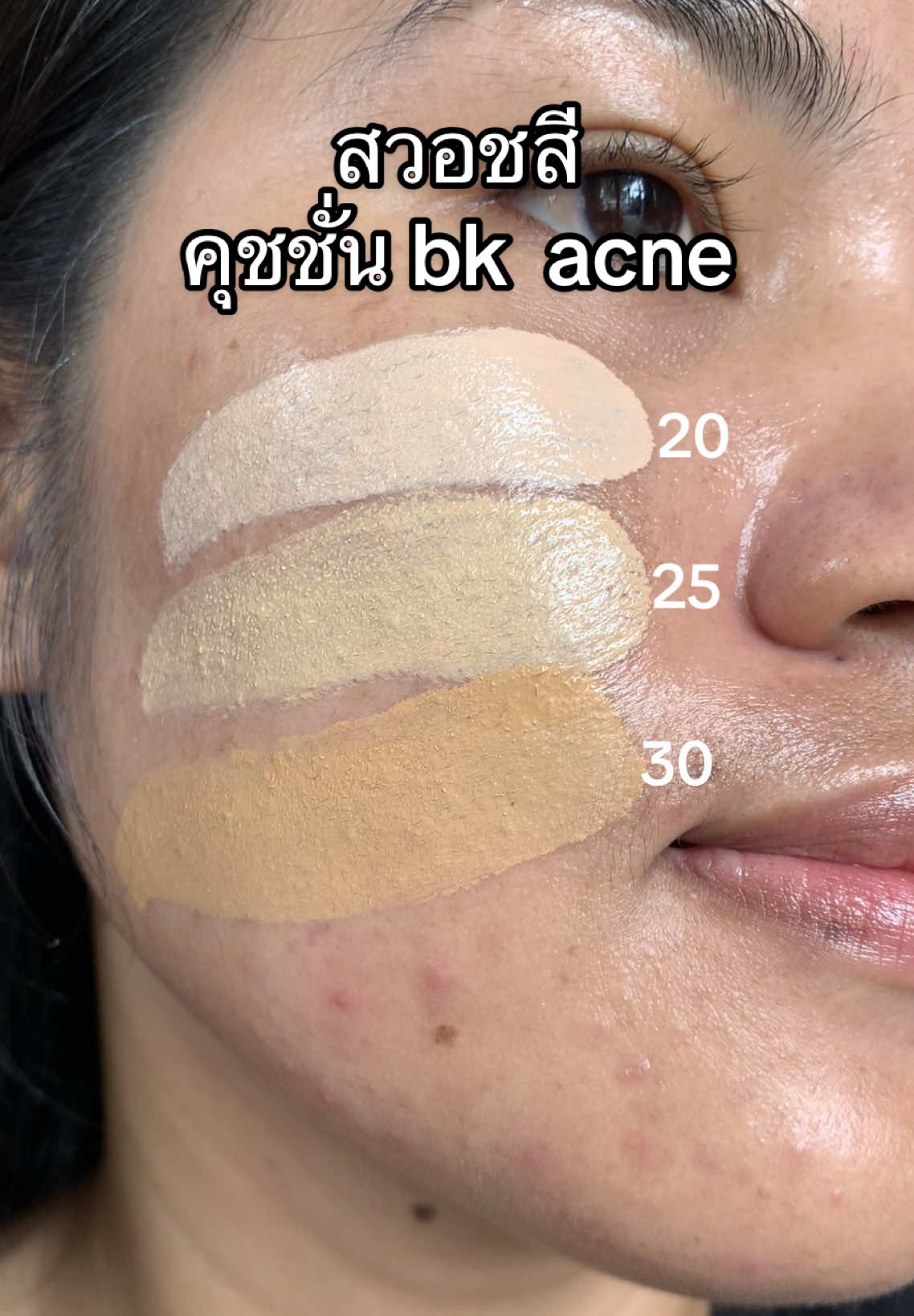 คุชชั่นที่เหมาะกับสภาพหน้าตอนนี้ #คุชชั่นสิวbk #คุชชั่นเกาหลี #bkacne #รีวิวคุชชั่น 