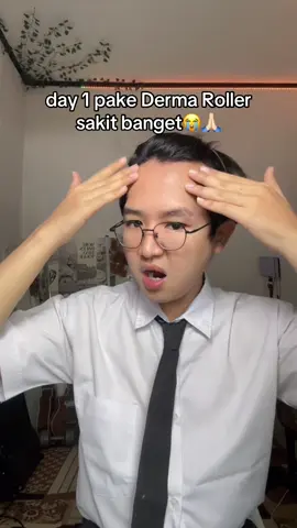 semoga beneran bisa merangsang pertumbuhan rambut 😭udah nahan sakit #dermaroller #babyhair #jenong 