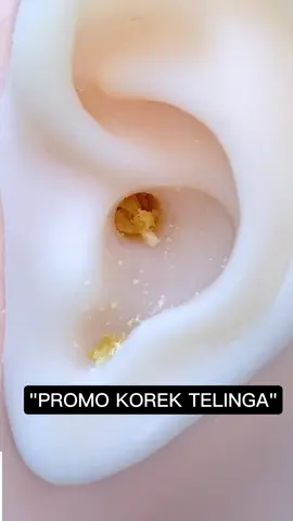 #korektelinga #pembersihtelingaset #pembersihtelinga 
