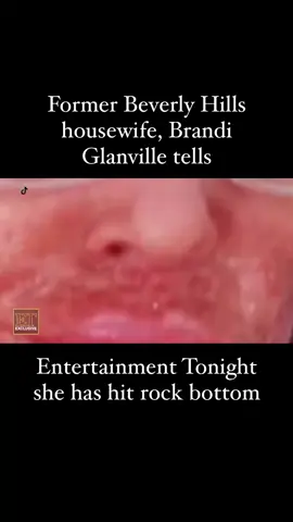 Brandi Glanville speaks to Entertainment Tonight about her ongoing health concerns. #realhousewivesofbeverlyhills#brandiglanville#entertainmenttonight#skincondition#parasite 
