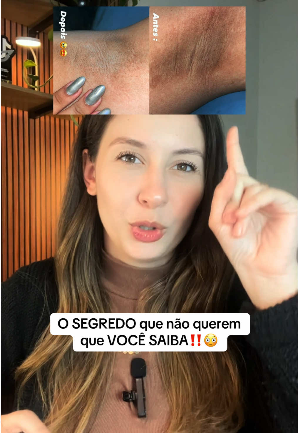 Uma solução pra todas as suas manchas? Sim, ela existe! ✨ Eu vivia frustrada com manchas no rosto, axilas escuras e ainda por cima a pele sem vida. Mas o meu segredo para uma pele perfeita é o Sérum Clareador MaxFem, que funciona como um verdadeiro 3 em 1! O link para o meu segredo de beleza está aqui no carrinho laranja, clique e garanta o seu, antes que acabe! 💖 #serum #serumclareador #clareador #clareadordemanchas #dicasdebeleza 