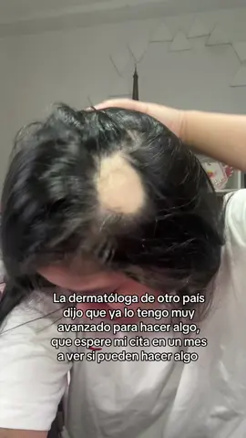 Así sigue mi caída del cabello, me dicen que no se puede hacer nada online hasta que la dermatóloga asignada me vea mi caso pero que mi probable me quede calva 😭 #calva #calvicie #alopecia #alopeciaariata 