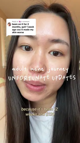 Replying to @💘 posting this a month late but there’s been so much improvement since stopping tretinoin #acnejourney #acneupdate #adultacne 