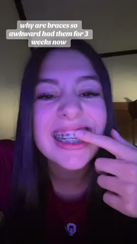 help please #fypシ゚viral #braces #bracestips #olebrandselect #helptiktokgroup 