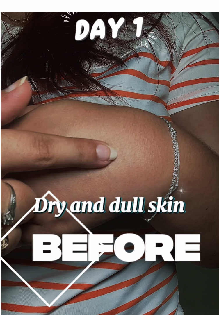 Goodbye, goodbye dehydration In the hands 🤚🏻! This eye cream 👀 2 in 1 double action is not just an eye cream! Treat hyperpigmentation in any area! @Mary&May Official @Mary&May Influencers @Mary&May Latam Official  #glutation #glutatión #darkcircles #eyecream #wrinklesmoothing         