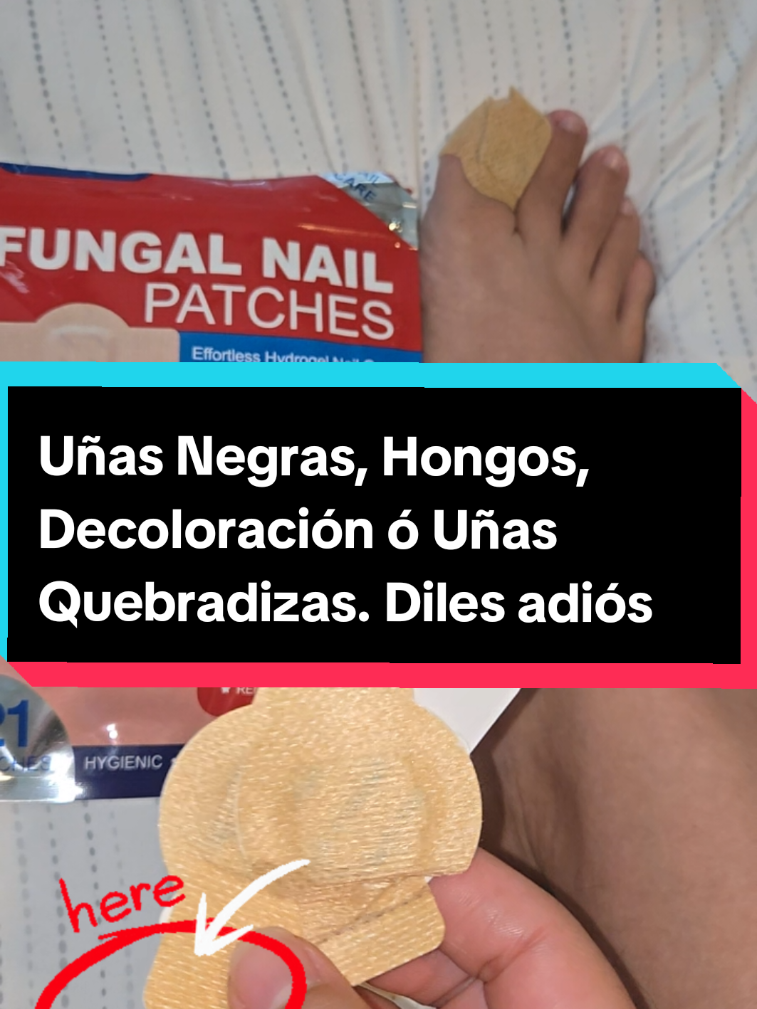 Hongos, decoloración, manchas negras en las uñas? Fungal Nail Patches, 21pcs/box Nail Health Care Patches, Nail Fungus Care Patches, Suitable for Solving Fungal Nails and Other Nail Problems, Nail Supplies, Daily Care Nails Kit Set, Nail Tech Supplies #nailhealth  #nailfungus  #tiktokshop  #nailtech #latinos 