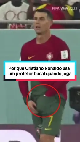 Por que Cristiano Ronaldo usa um protetor bucal quando joga? #futebol #futebolbrasileiro #CapCut 
