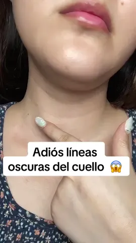 Pensé que las líneas oscuras del cuello eran para siempre… 💔 pero este retinol suave me demostró lo contrario 👀✨  El 0.1% Gentle Retinol Serum de Dr. Althea las fue aclarando sin irritar, y ahora mi cuello se ve muchísimo más uniforme 🪞💛 #DrAlthea #RetinolSuave #retinolskincare #SkincareCoreano #SkincareHack          @dr.althea_es @Dr.Althea US 