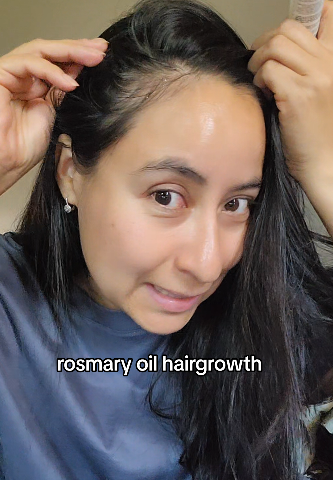 #rosmaryoilgrowth #hairloss #caidadecabello #aceitederomero #cuerocabelludo 