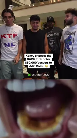 Konvy exposes the DARK truth of his $30,000 Veneers to  Adin Ross 😭 #adinross #kick #konvy #clips #funny 
