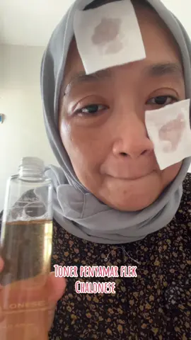 Owner penyamar fle dan pencerah wajah kusam #chalonese #chalonesetoner #chaloneseskincare @Chalonese 7 @CHALONESE perawatan kulit #fypage #belidisini 