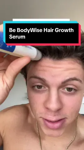 This ain’t normal bro… #hairgrowthserum #hairline #men  
