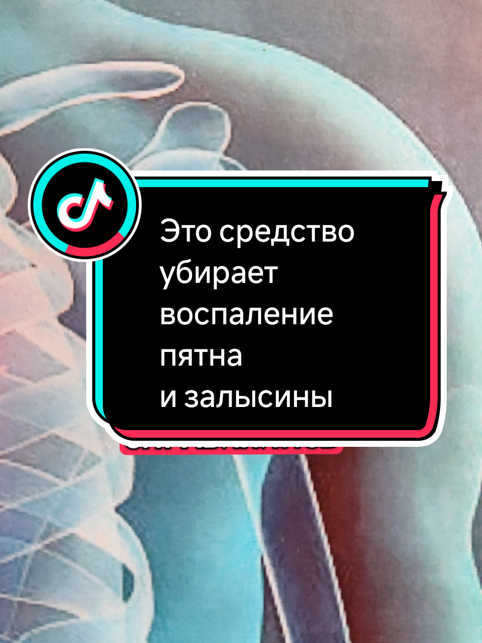 Это средство убирает воспаление пятна и залысины #здоровье 