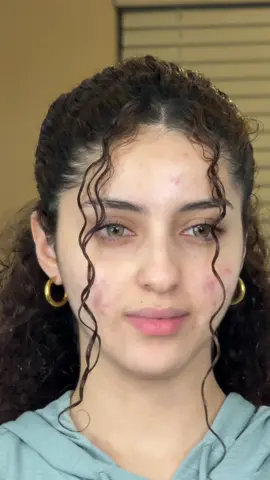 You thought acne was my whole personality… wait here 🪄✨ #makeup #acne #makeuptutorial #bareface 