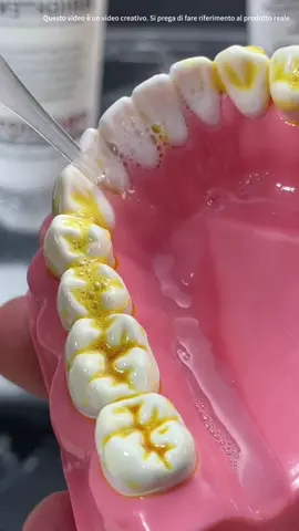 Yellow teeth ?It doesn’t exist!This toothpaste makes teeth white enough to be like light bulbs #tiktokshop #fyp #fouyou #teeth #tooth     ###
