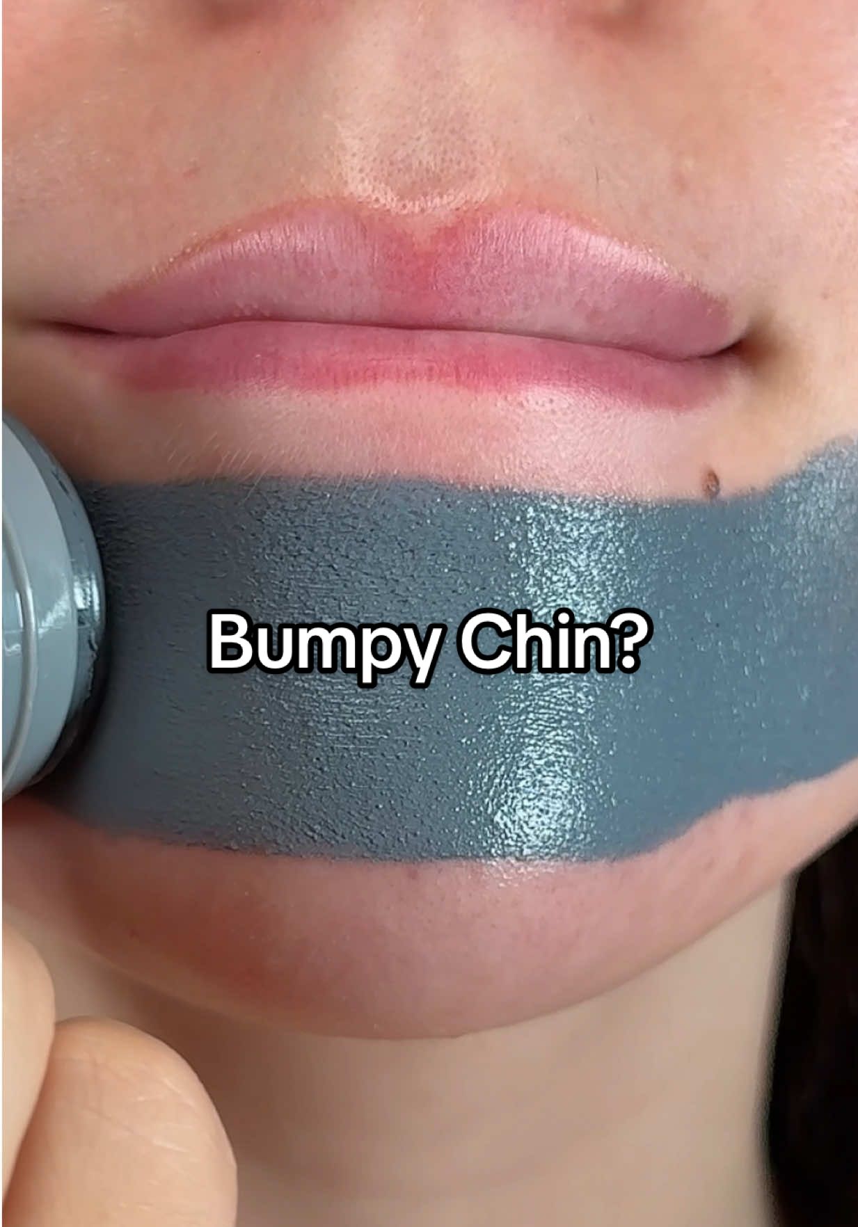 When your bumpy chin needs an emergency fix 🌋 #bumpyskin #cloggedpores #claystick #skintific #cleanpores
