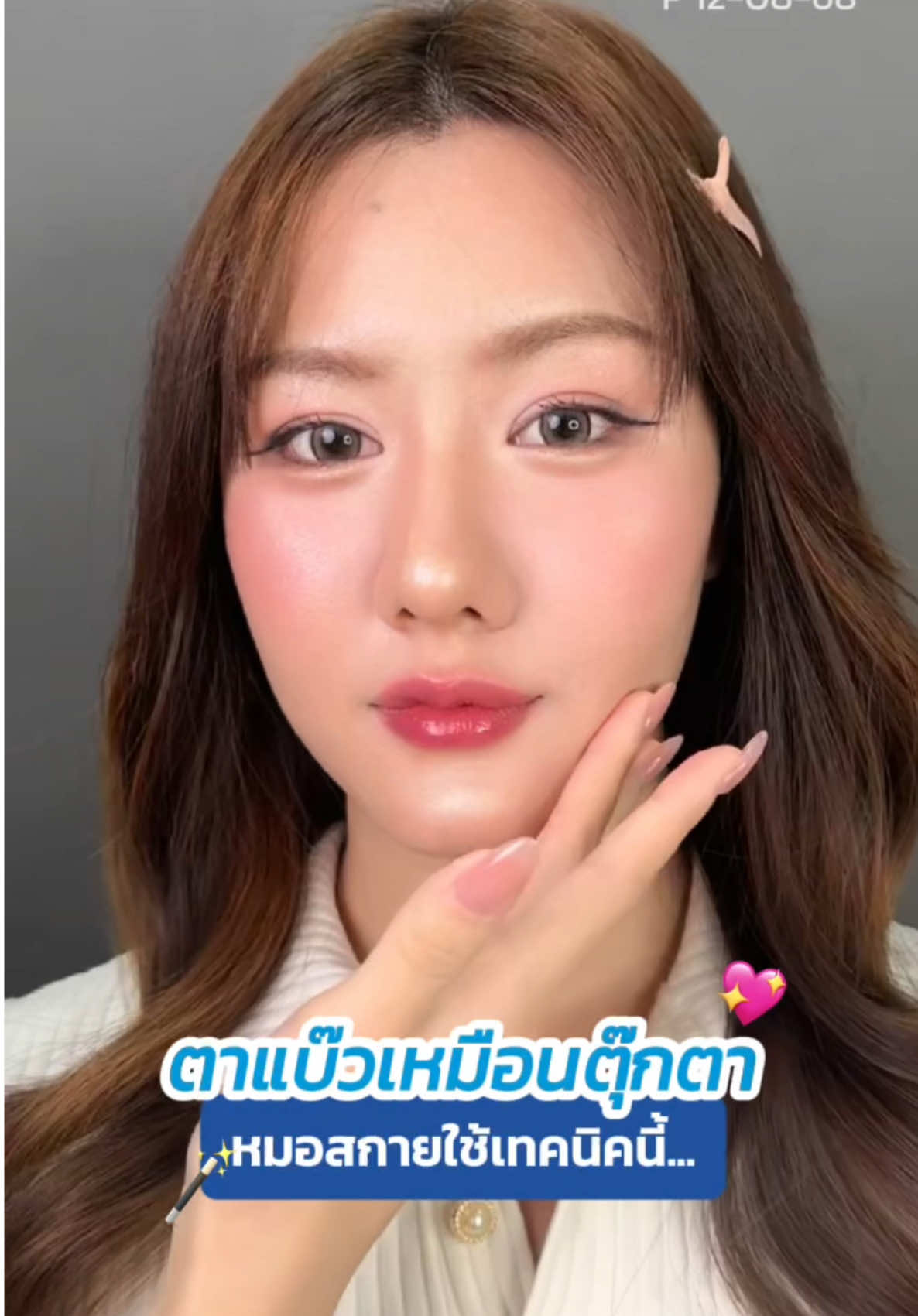 ตาแบ๊วเหมือนตุ๊กตา เพราะ #หมอสกาย 😍💖 #รีวิวตาสองชั้น #skyclinic #จักษุแพทย์ #ทำตาที่ไหนดี 