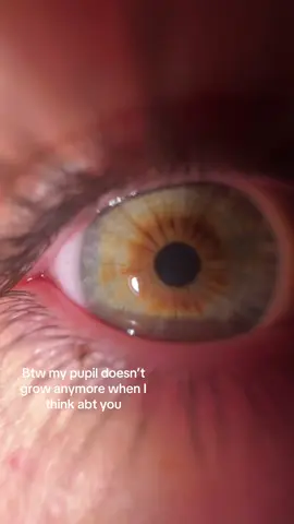 Ignore how much I’m blinking it’s annoying me #eyes #fyp #jesuslovesyou #viral #xyzbca 