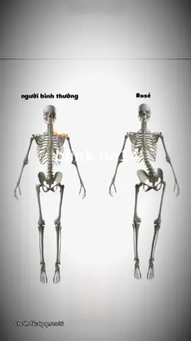 Ng bth đứng với cách cổ đứng 🤭#Rose #roses_are_rosie #numberones  #xh #viral 