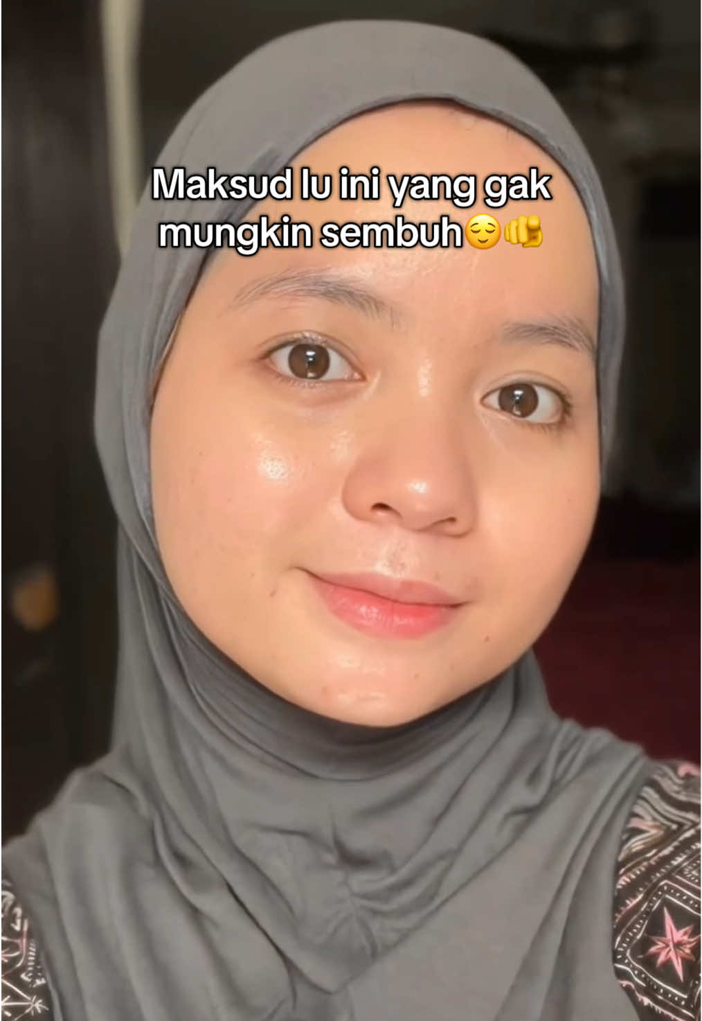 Gak ada yg gak mungkin apalagi kalo udah nemu produk yang tepat👌#acnecleanser #acnefacewash 