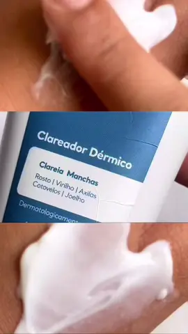 O clareador dérmico da @Cicatribem é ideal para tratar manchas de acne, axilas, joelhos e cotovelos, tem 96% de eficácia, estimula na produção de colágeno e tem um cheirinho incrível. Clica no link e usa meu cupom 🏷️CAMILAA10 para garantir 10% de desconto.  https://clareador.cicatribem.com.br/?utm_source=INFLUENCER&utm_campaign=Camila_da_Silva_Ferreira&utm_id=CLAREADOR 