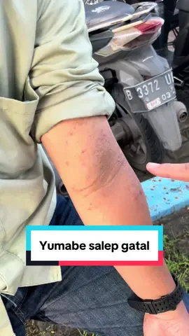 Panu,kadas,kurap,exim,gatal_gatal dan penyakit kulit lain nya yang disebabkan bakteri pada kulit #salepgatal #yumabe#salepherbal #tiktokshop 