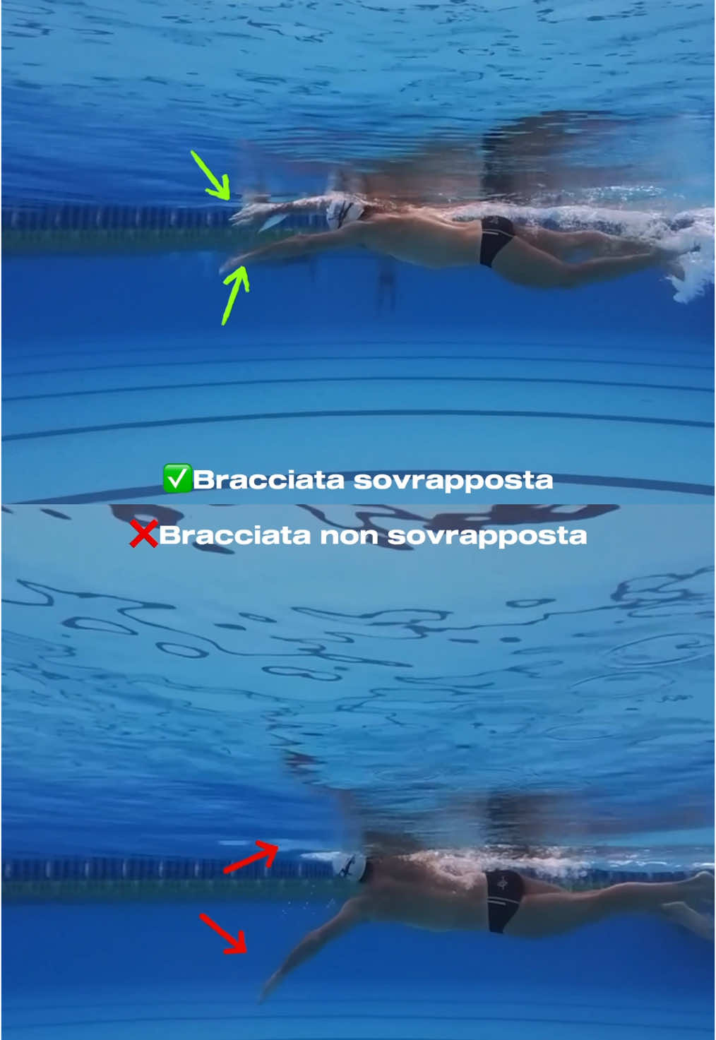 ❌Quando un braccio entra in acqua troppo tardi e l’altro inizia già la fase di trazione, ecco che viene a mancare una corretta coordinazione. Ciò ovviamente porta ad un ridotto equilibrio e ad uno scarso galleggiamento ✅Con la giusta sovrapposizione, invece, l’entrata di un braccio coincide con l’inizio della presa dell’altro, quasi come se volesse raggiungerlo  💡Questo piccolo accorgimento rende la nuotata più fluida, stabile ed economica. Ideale per distanze lunghe e di mezzo fondo (ma usata anche in gare da 100 m) Mentre, negli sprint brevi, si preferisce ridurre la sovrapposizione per aumentare la frequenza di bracciata #nuoto #swim #swimprove #stilelibero