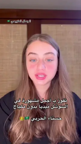 #الجمال_السعودي#الجمال_الطبيعي #fyp #🇸🇦#saudigirl #blond 