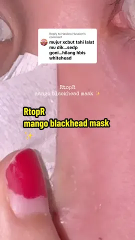 Replying to @Haslina Hussien  kan , memang best keluar habis whitehead 😭 #blackheadremover #whiteheadsremoval #fyp #intanshaidaa 