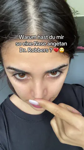 Verpfuschte Nase wer kann meine Nase retten?  #nasenop #operation #revisiontips 
