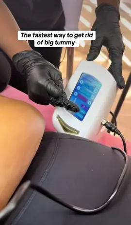 #fypシ゚ #goviral #extremeskinsations #microneedling #0759756417 