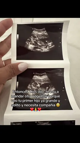 #misegundoregalitodedios🙌🏻🙏🏻💝💝  #bebeencamino🤰 