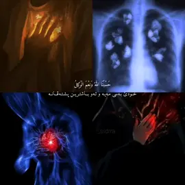 #حسبيا_الله_ونعم_الوكيل #💔🥀 ###دهوك_زاخو_سليماني_ئاكري_ئامیدی_هولیر ##duhok_zaxo_amedi_semel_akre ###