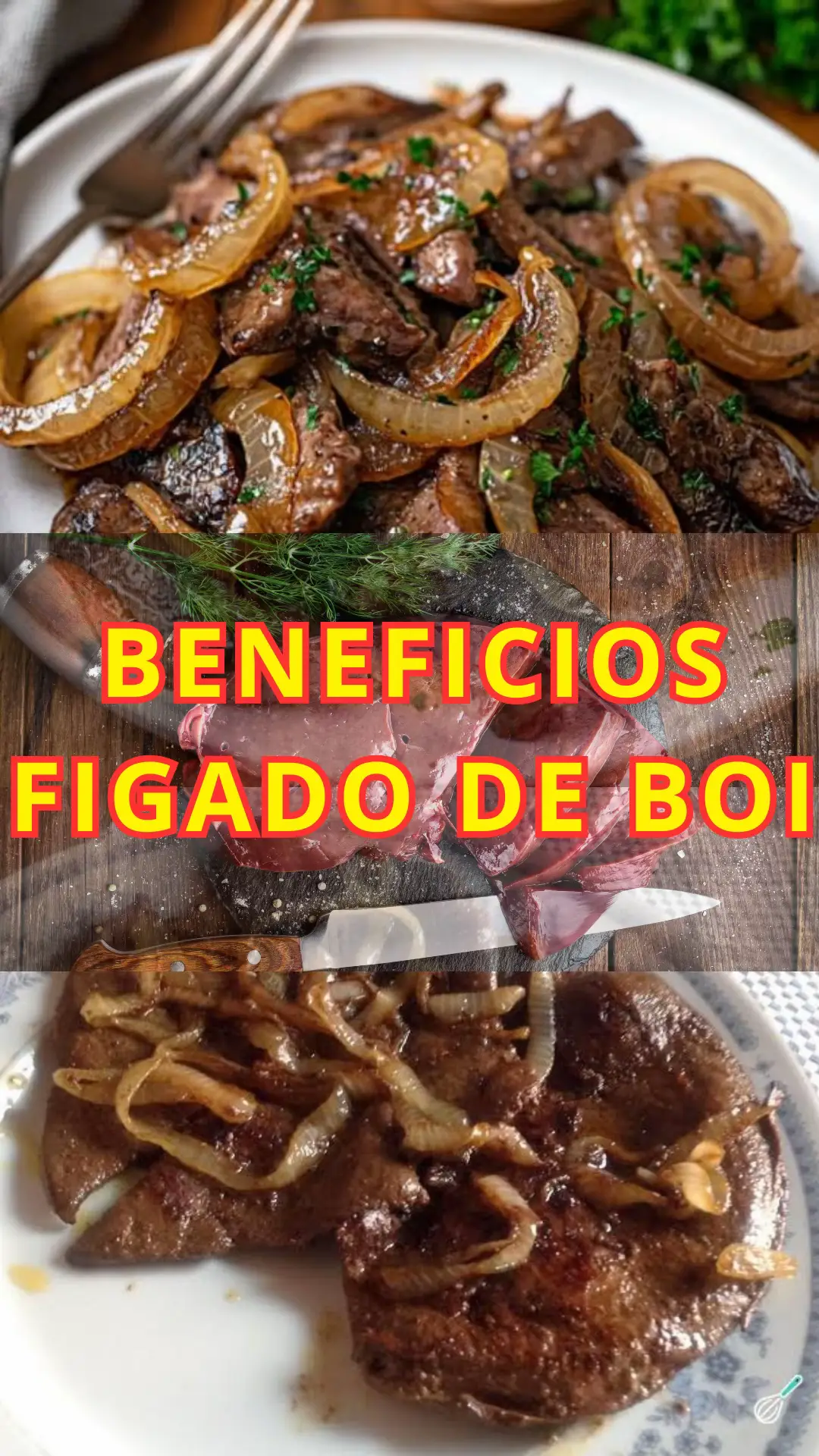 Benefícios do fígado de boi: ✅Riquíssimo em ferro heme O tipo de ferro mais facilmente absorvido pelo corpo. Excelente para prevenir e tratar anemia ferropriva. ✅Fonte concentrada de vitamina A Importante para visão, pele saudável e sistema imunológico. ✅Altos níveis de vitamina B12 Essencial para formação de glóbulos vermelhos e saúde neurológica. ✅Proteína de alta qualidade Fornece aminoácidos essenciais para manutenção e recuperação muscular. ✅Zinco, selênio e fósforo Minerais que fortalecem imunidade, ossos e fertilidade. ✅Energia e disposição A combinação de ferro + vitaminas do complexo B ajuda a combater cansaço físico e mental. ✅Colina Nutriente fundamental para a saúde cerebral e função hepática. Como consumir -Cozinhar rapidamente para não perder nutrientes (grelhado, cozido ou acebolado). -Evitar fritar em excesso para não oxidar as gorduras. -Para melhor aproveitamento de ferro, combine com alimentos ricos em vitamina C (ex: limão, laranja). 💡 Curiosidade: O fígado de boi é tão nutritivo que, em 100g, você já cobre e até ultrapassa as necessidades diárias de várias vitaminas e minerais. Mas, por ser muito concentrado em vitamina A, não é bom exagerar no consumo diário. . . . #saude #saudeebemestar #figadodeboi #saudavel 