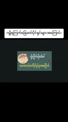 ဂမ္ဘီရကြက်ခြေခတ်ပိုင်ရှင်များအကြောင်း#fyp #foryou #foryoupage #ဗဟုသုတ 