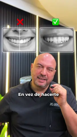 💎 Transforma tu sonrisa con tratamientos que realmente valen la pena. ✔ Alineadores invisibles, sin brackets y con la misma efectividad. ✔ Microdiseño de sonrisa para un cambio sutil y elegante. ✔ Implantes de titanio con garantía de por vida. ✔ Disilicato: resistencia y color natural en tu diseño de sonrisa. Tu sonrisa es tu carta de presentación… ¿por qué no hacerla perfecta? 😁✨ #DiseñoDeSonrisa #AlineadoresInvisibles #ImplantesDentales #EstéticaDental #sonrisaperfecta 