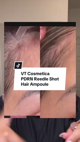 FLASH sale girls! Yall know I’ve been stuck on this because it’s given RESULTS! Do yall have any questions?? Lmk! #vtcosmetics #reedleshothairampoule #hairgrowth #postpartumhairloss @VT Cosmetics US 
