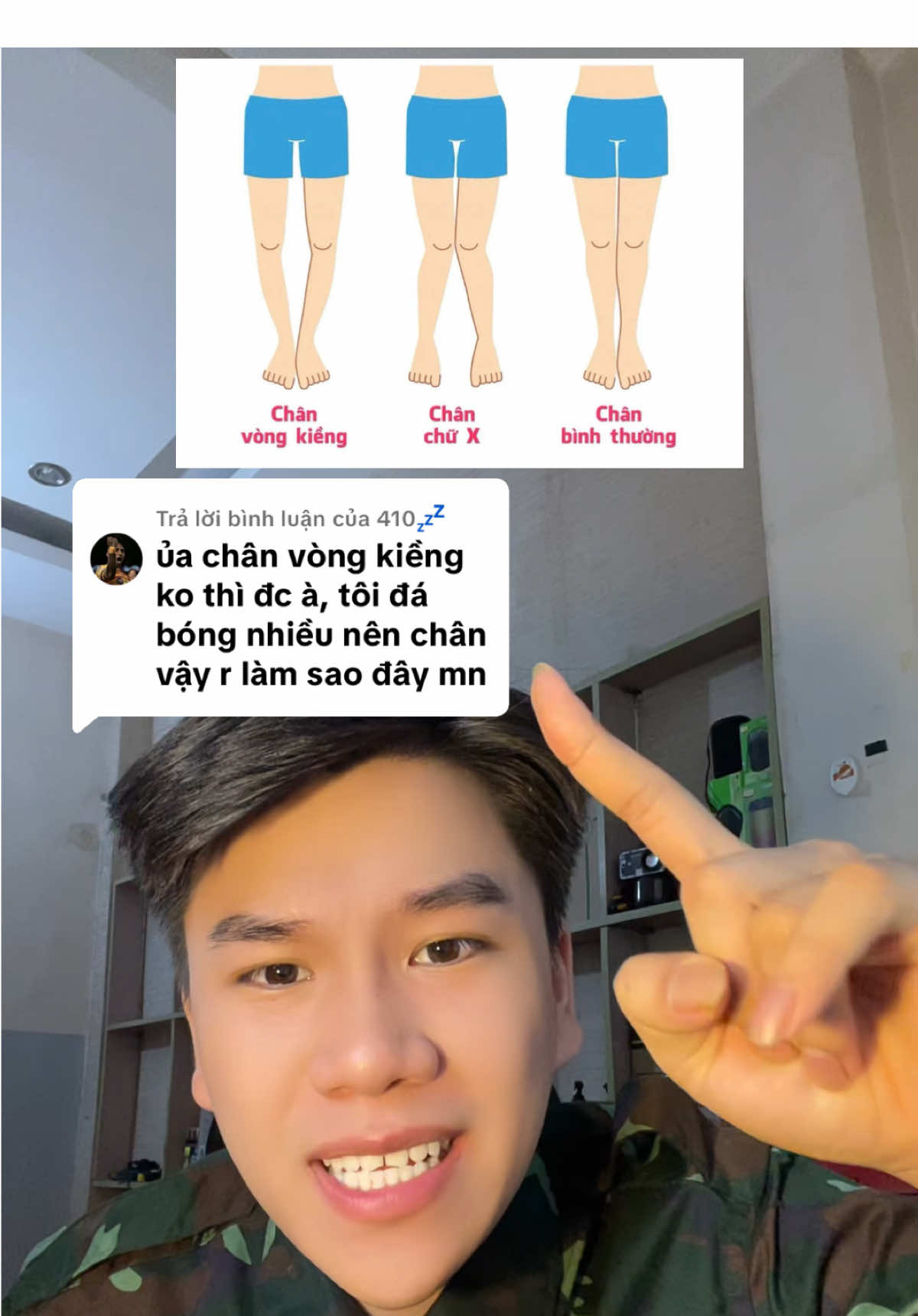 Trả lời @410💤 Cách điều chỉnh chân vòng kiềng để vào được Quân đội và Công An siêu hiệu quả nhiều người áo dụng! #nhapngu #tuyensinhquandoi #tuyensinhquansu #chanvongkieng #tuyensinhquansu 