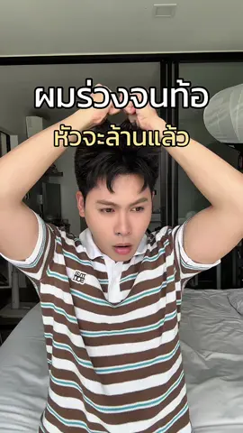 ผมร่วงจนท้อ หัวจะล้านอยู่แล้ว  #วิตามินผม #ลดผมร่วงผมบาง #ผมร่วงผมบาง #ผมขาดหลุดร่วง #ลาคาน่า 