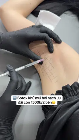 Botox khử mùi hôi nách chị em đã biết chưa ạ🥰🥰#botox #khumuihoinach #botoxnach 