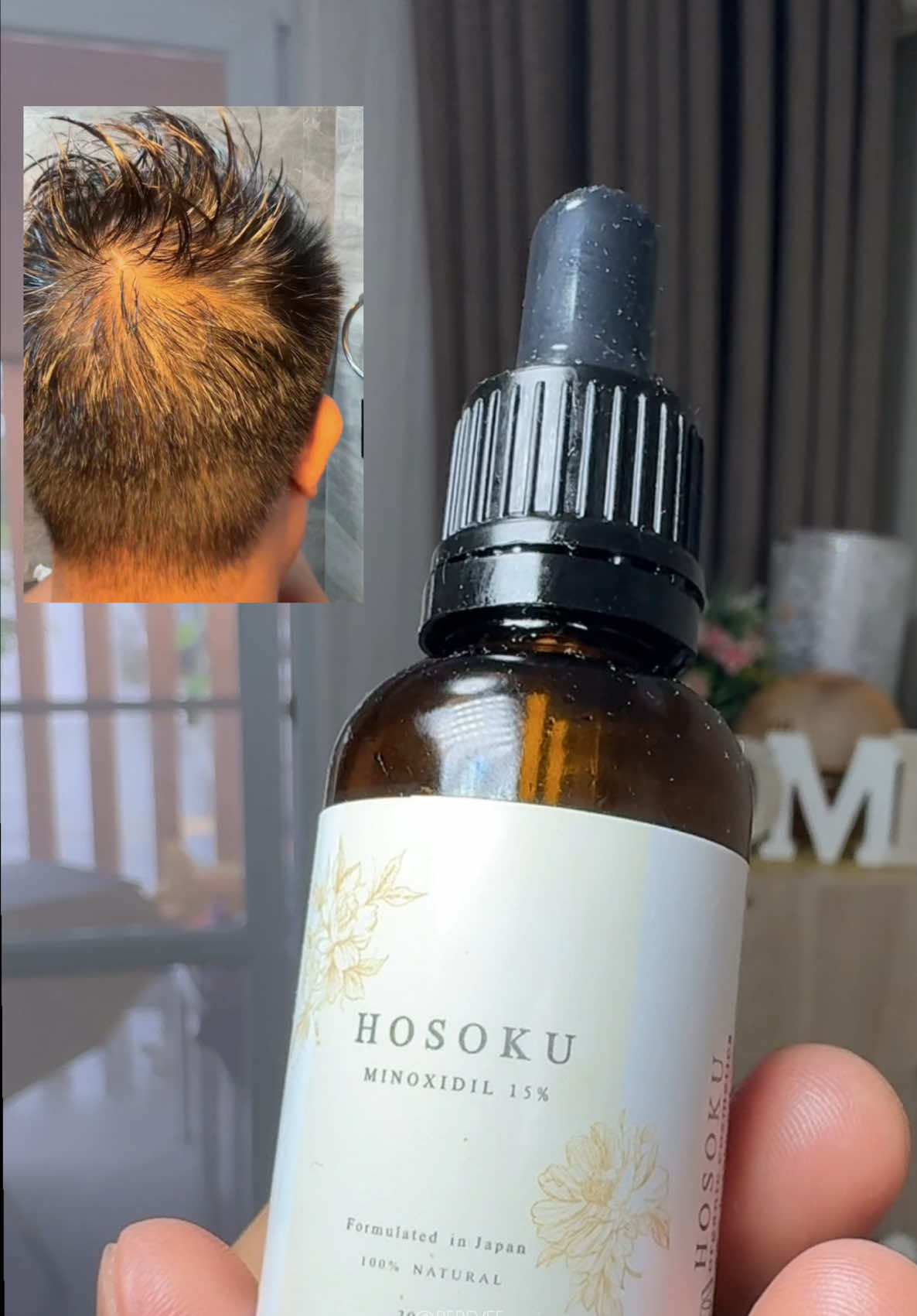 Click mo dito sa yellow basket if gusto mag order thank you HOSOKU MINOXIDIL 15% HAIRGROWTH HAIRGROWER HAIRLOSS SOLUTION  #trendingproducts #viralproducts #tiktokshop #shoppingtips #foryou 