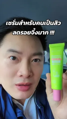 เซรั่มมะรุมเปปไทด์ #เซรั่มมะรุมเปปไทด์ #จุฬาเฮิร์บ #ลดรอยดํารอยแดงจากสิว #รีวิวบิวตี้ #ส่งฟรี 