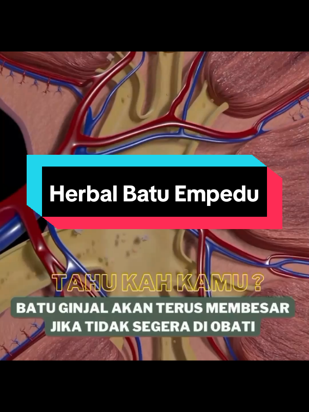 Vellare Bharata Herbal Batu Empedu #vellarebharata #herbal #batuempedu 