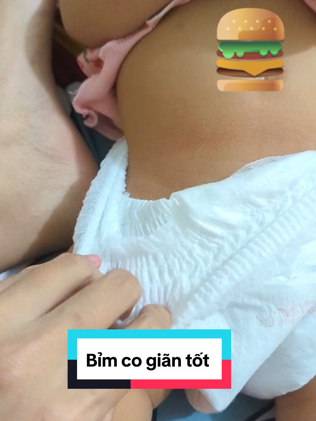 Trả lời @mebimboxoai25 Tui dùng loại này không có để lại mấy cái dấu đỏ trên bụng của con nè mấy bà #mebimsua #mebim #bimchobe #bimgiare #bimtotchobe 
