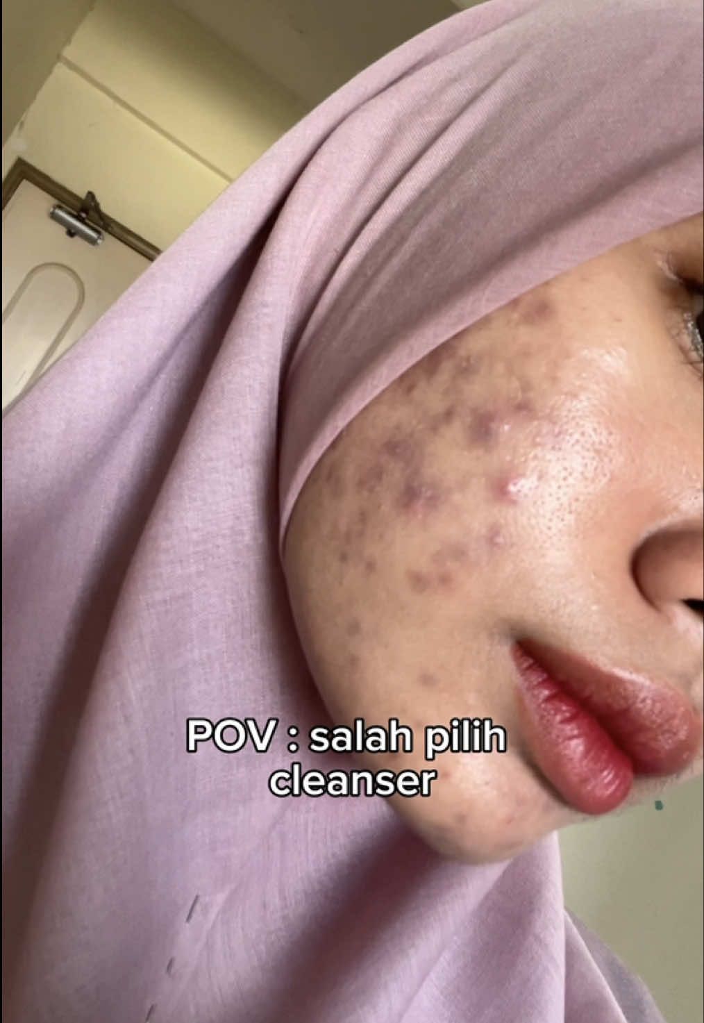 Makan tahun juga ehh nak cari cleanser yang sesuai untuk repair skin barrier i ; )  #skintificmy #skintificmalaysia #acnefighter 