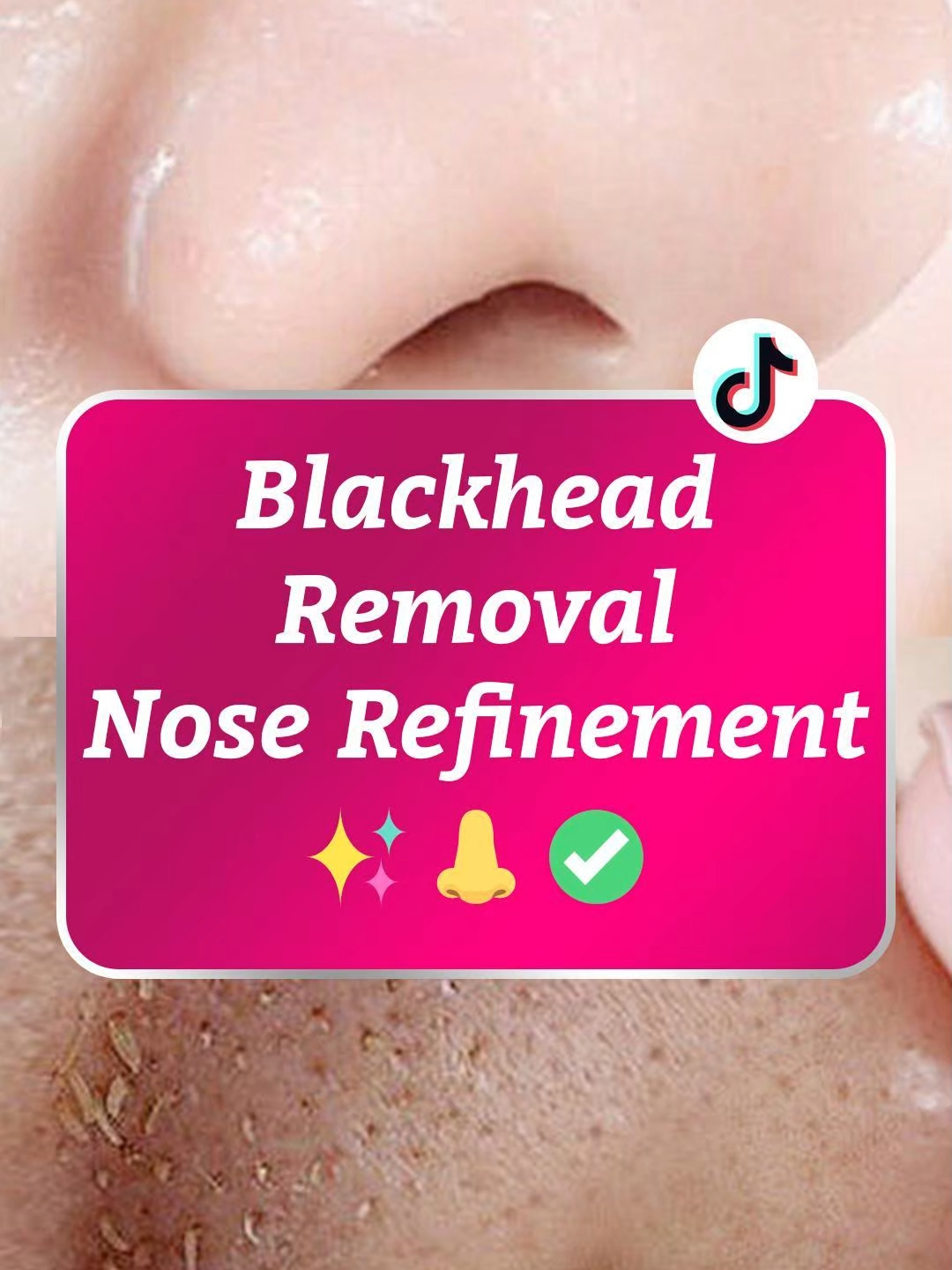 🍑✨ Mag-apply lang, dumikit, at mag-peel para madaling ma-absorb ang sobrang mantika at dumi, linisin nang malalim ang mga pores, at huwag mag-iwan ng lugar para magtago ang mga blackheads! ✨#RtopR#SkincareRoutin#nose#ClearSkin#BlackheadRemoval#balat#G041