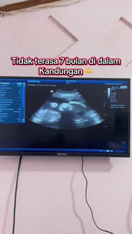 Masya Allah tabarakallah #hamilcantik #trending #pregnant ##trimester2 #hamiltm3 