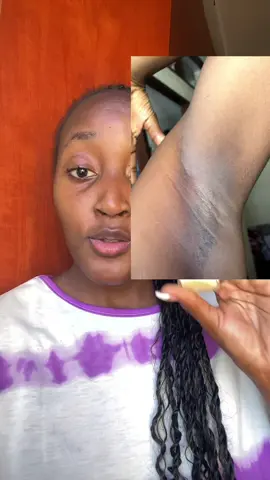O pin que tem me ajudado muito a clarear a axila escura estou no processo ainda mas tem sido um milagre o contacto para quem quiser o creme 872315923 ao para WhatsApp amigas #axilasoscuras#axila#manchas#tiktokmocambique🇲🇿  