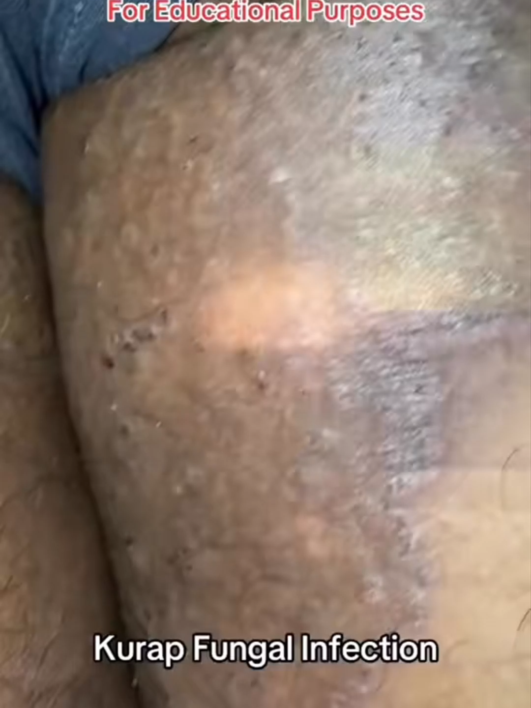 Dokter kulit jamin! Oles tipis-tipis tiap hari, perubahan kulit bakal ketauan dalam 7 hari.